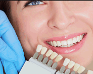 Lentes de Contato, Facetas, Clareamento. Affeto Odontologia