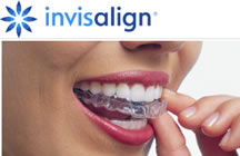 Alinhador Dental, Invisalign